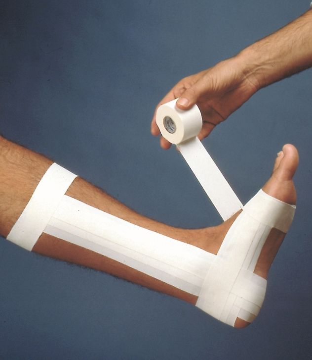 Steroplast: Zinc Oxide, Sports Injury Tape (5cm Wide by 10m Long) ST4059